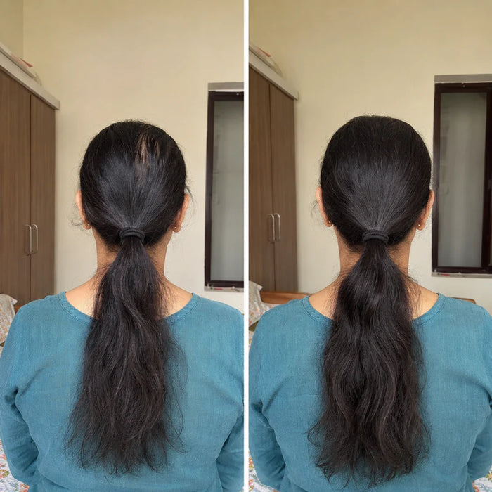 Nuskhera 19-Herb Bhringraj  Hair Oil