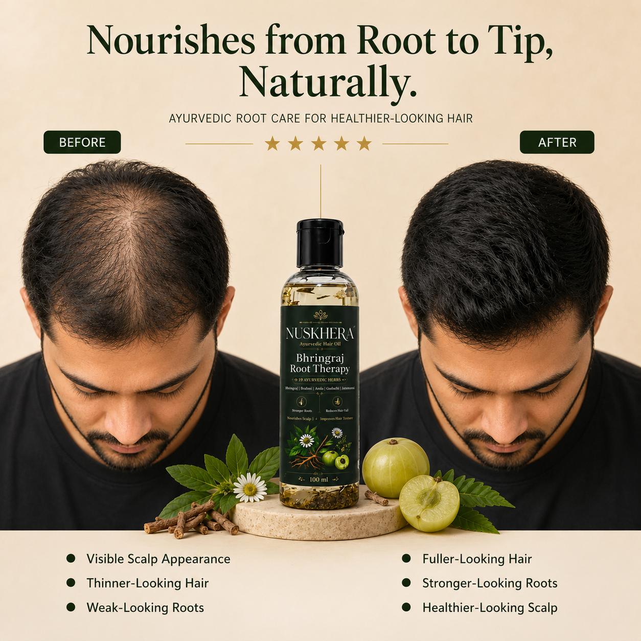 Nuskhera 19-Herb Bhringraj Ayurvedic Hair Oil